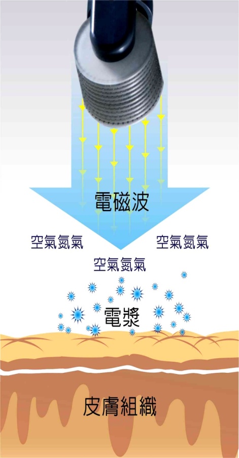 愛瑪電熱刀系統